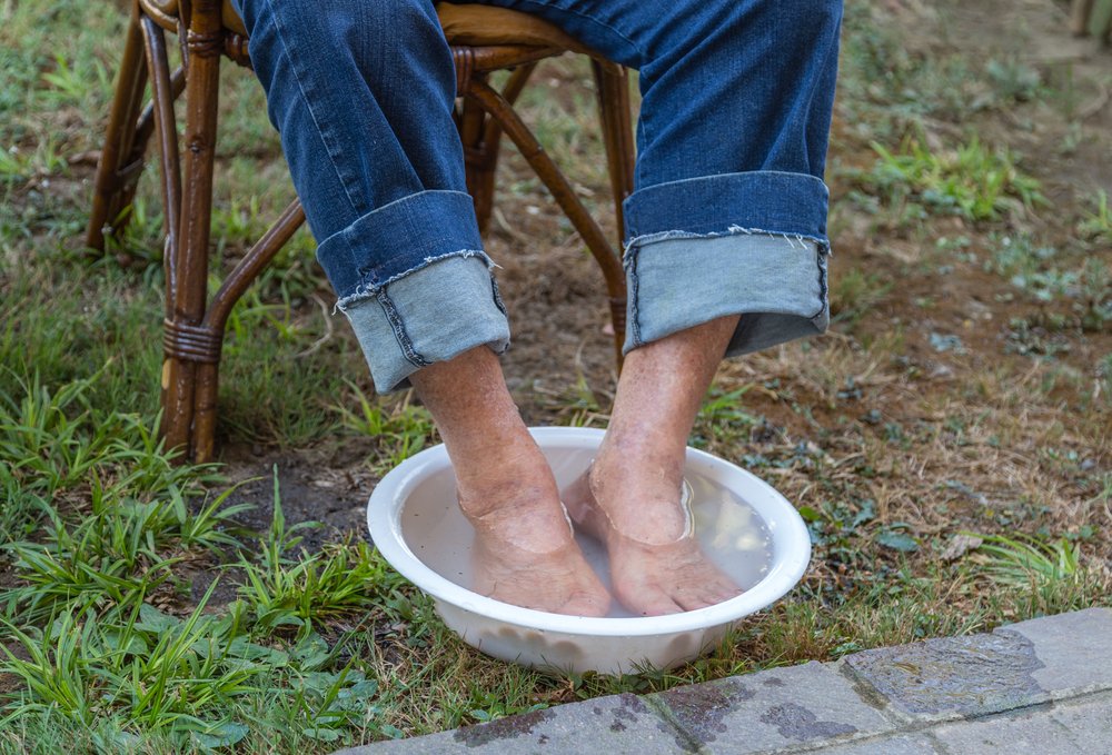 Talloni screpolati? Rimedi naturali e 5 creme efficaci da provare 3 talloni screpolati: rimedi naturali