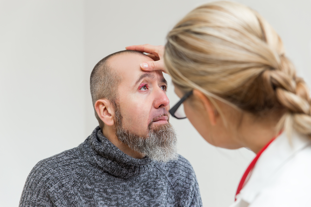 Orzaiolo: cos'è, come riconoscerlo e le cure più efficaci 2 orzaiolo: diagnosi e cura
