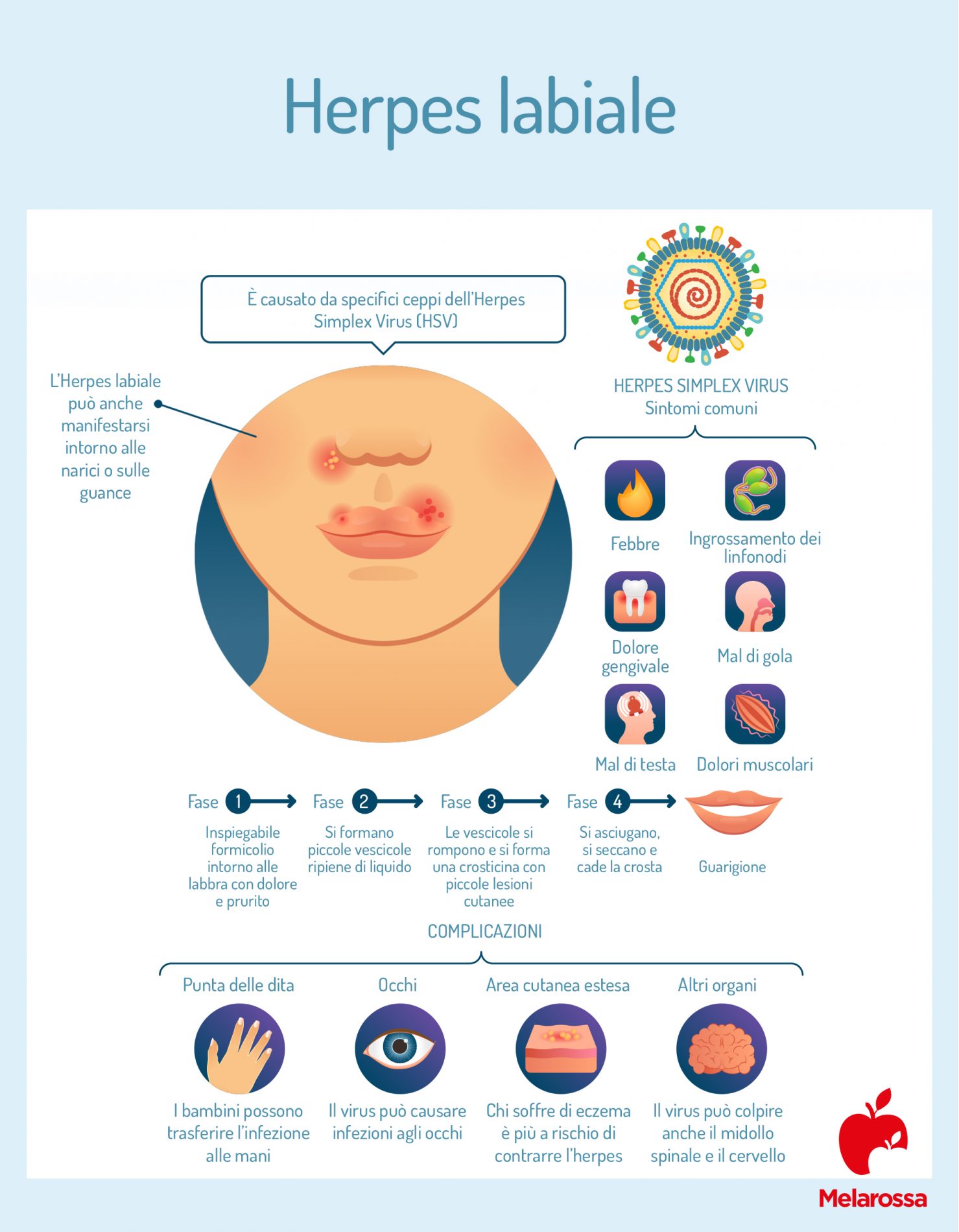 Herpes labiale: sintomi, diagnosi e cura 1 Herpes labile: cos'è