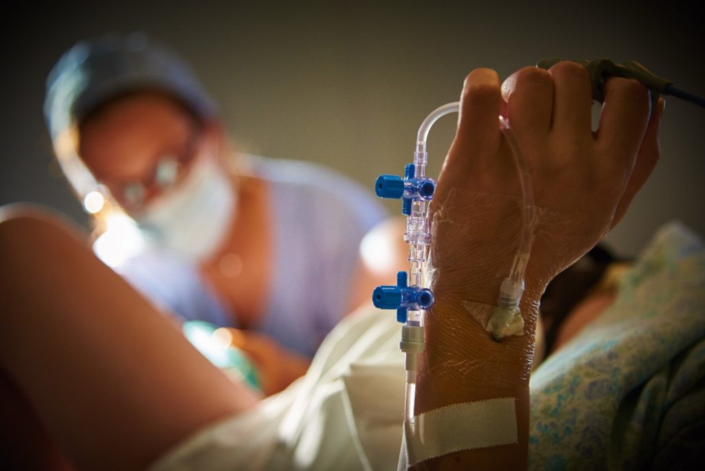 Parto naturale: le sue fasi, le posizioni e la gestione del dolore 10 epidurale durante il parto naturale cos'è