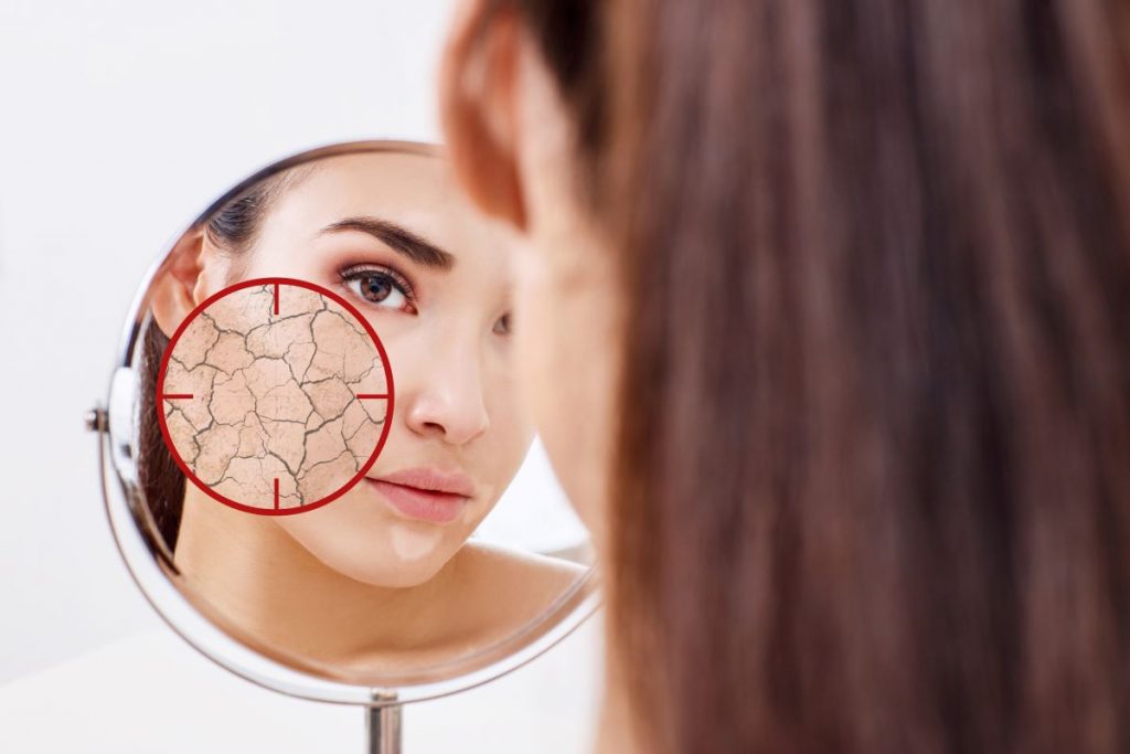 Dormire truccate: ecco cosa rischi se dimentichi di rimuovere il make up dal tuo viso 2 pelle-secca-viso