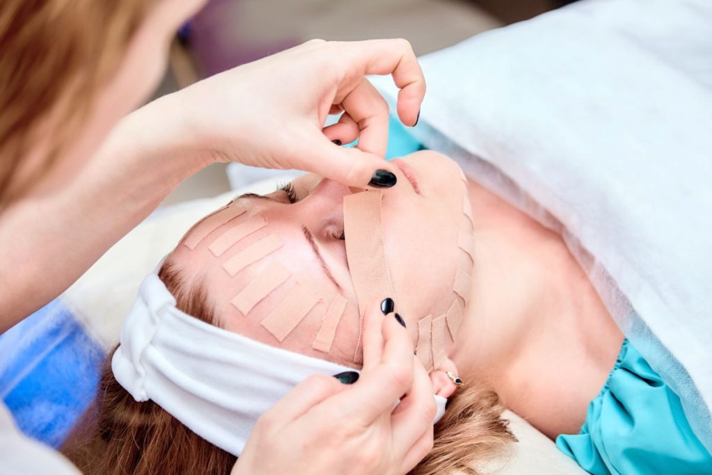 Come eliminare le rughe dal viso: arrivano i cerotti facciali (aesthetic face taping) 2 rughe-trattamento-cerotti