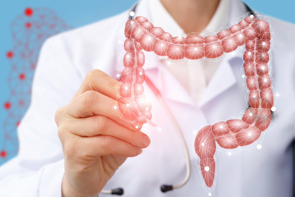 Tumore del colon-retto, scoperta la proteina che lo fa crescere (e che può farlo regredire) 1 Tumore del colon-retto: cause, sintomi, prevenzione, ruolo dell'alimentazione