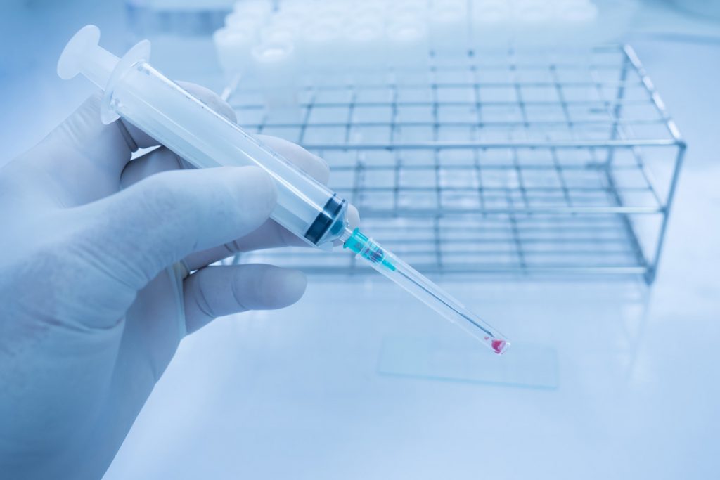 Tumore alla tiroide, un nuovo test diagnostico promette di evitare interventi chirurgici non necessari 1 tumore tiroide troppi interventi chirurgici per diagnosi incerta