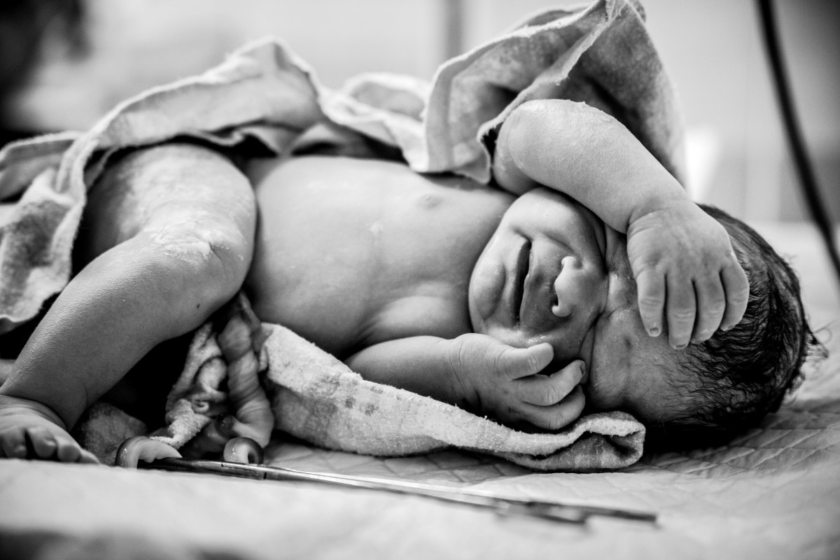 Parto cesareo: cos'è, come si svolge, quando è indicato, rischi, convalescenza e ritorno a casa 5 parto cesareo cosa sente il bambino