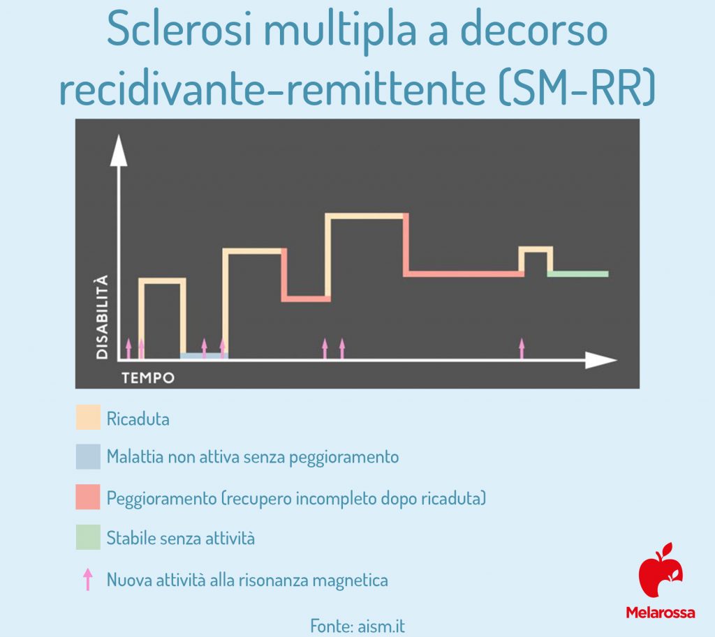 Sclerosi multipla: che cos'è, sintomi, diagnosi e cura 5 Sclerosi multipla decorso recidivante remittente