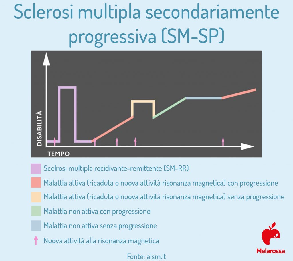 Sclerosi multipla: che cos'è, sintomi, diagnosi e cura 6 Sclerosi multipla secondariamente progressiva