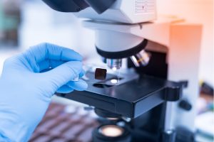 Tumore del colon, scoperte cellule dormienti che resistono alle cure: passo avanti per lo sviluppo di terapie pi&ugrave; efficaci