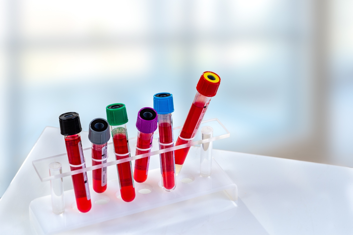 Analisi del sangue: quando farle, a cosa servono e valori di riferimento 2 analisi del sangue: valori di riferimento