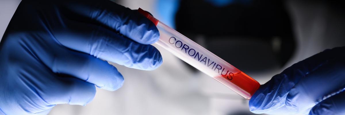 Coronavirus: glossario per capire meglio che cos'è 1 coronavirus: glossario delle parole principali per capire che cos'è