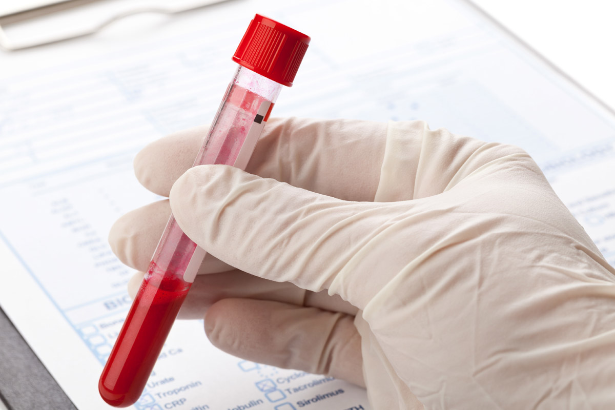 Menopausa: un test per prevedere quando arriverà 1 test sangue per prevedere inizio menopausa