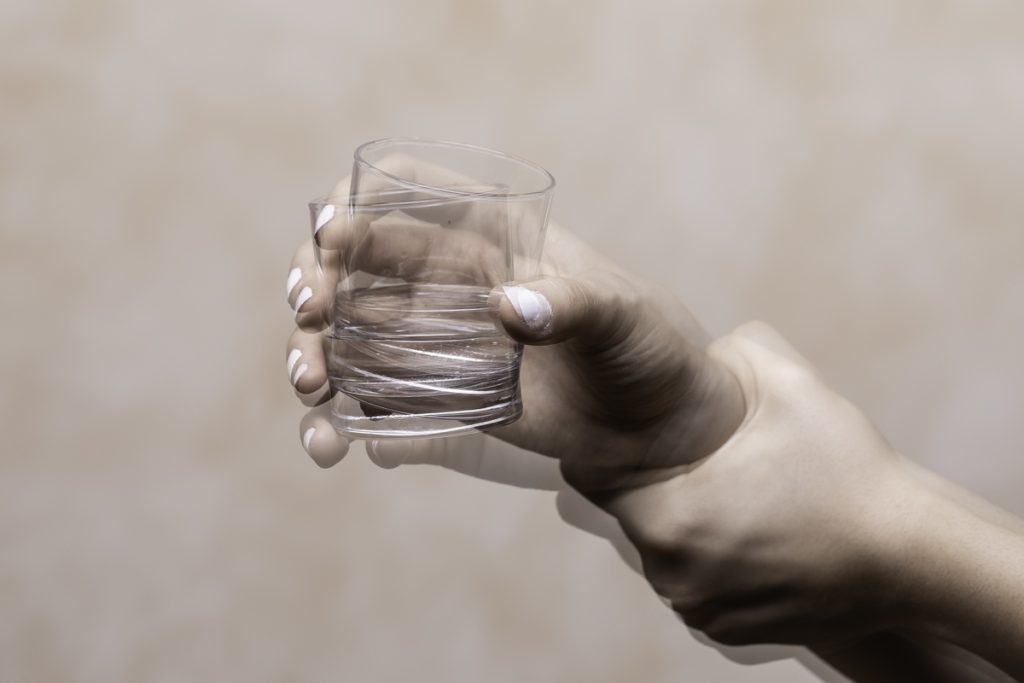 Parkinson, dalla ricerca nuove possibilità terapeutiche 1 Possibile alleviare gli effetti collaterali della L-Dopa per la cura del Parkinson