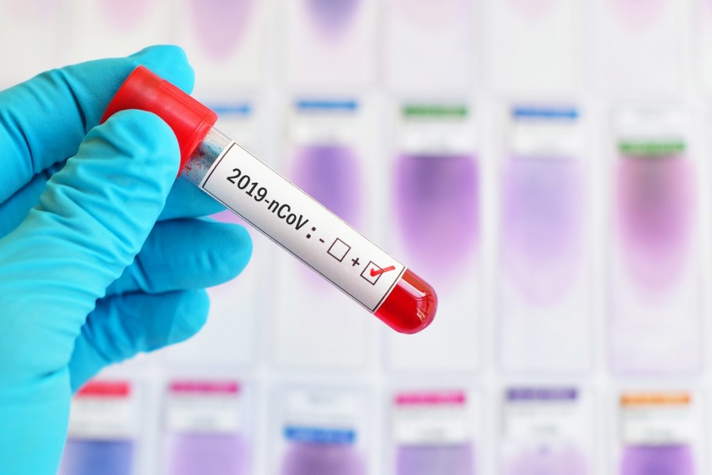 I consigli dell'Oms per arginare lo stress da Coronavirus 1 Lo stress da Coronavirus colpisce adulti e bambini