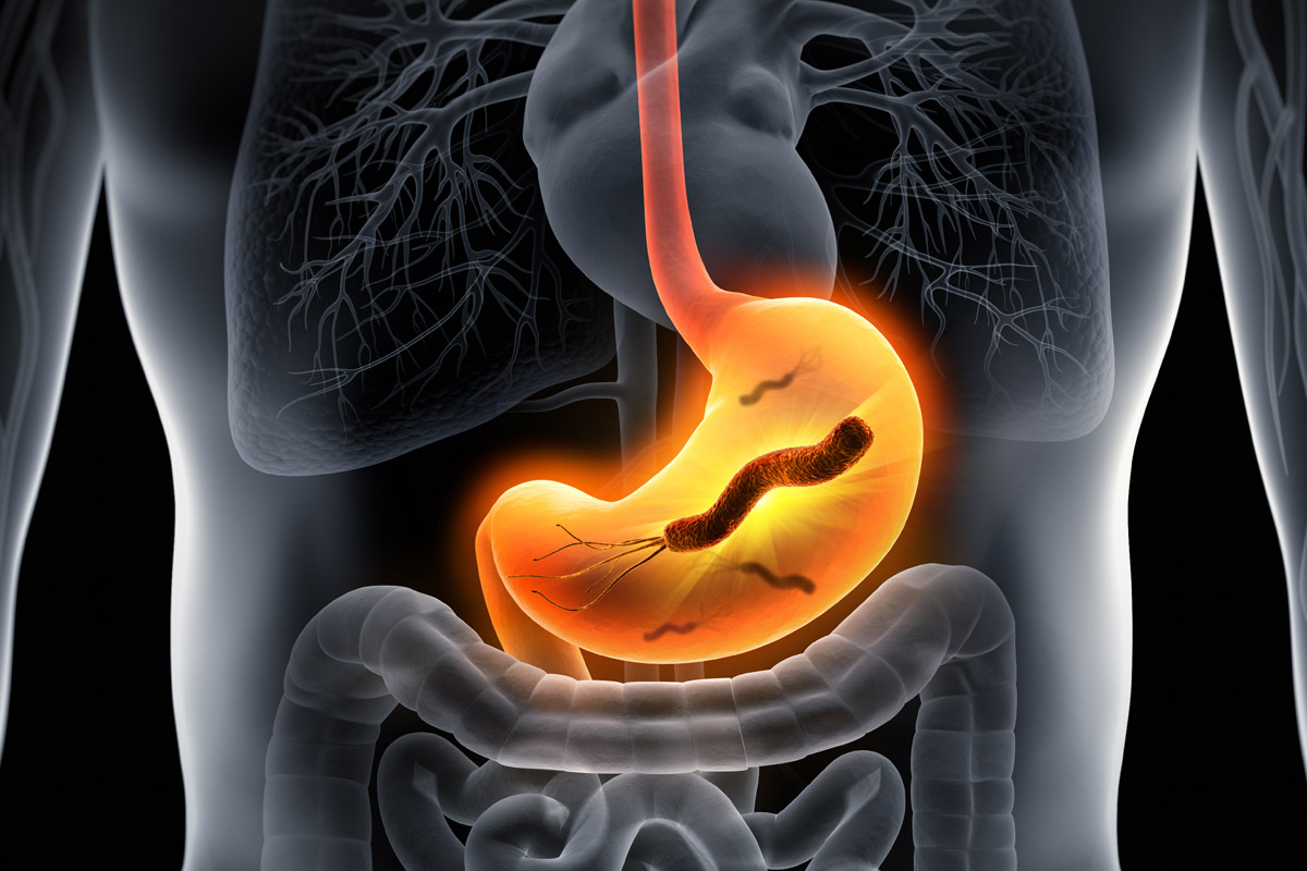 Helicobacter Pylori: cos'è, contagio, sintomi, complicanze, test e cure 1 Helicobacter batterio stomaco