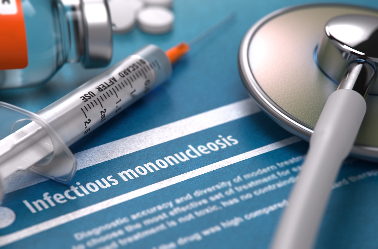 Mononucleosi: cos'è, cause, sintomi, decorso, trattamento e prevenzione 7 mononucleosi: diagnosi