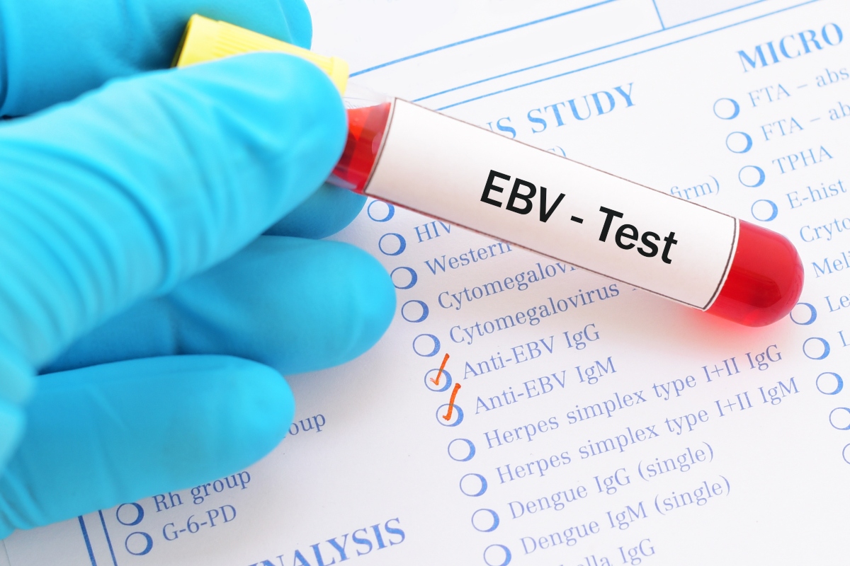 Mononucleosi: cos'è, cause, sintomi, decorso, trattamento e prevenzione 2 mononucleosi: epidemiologia