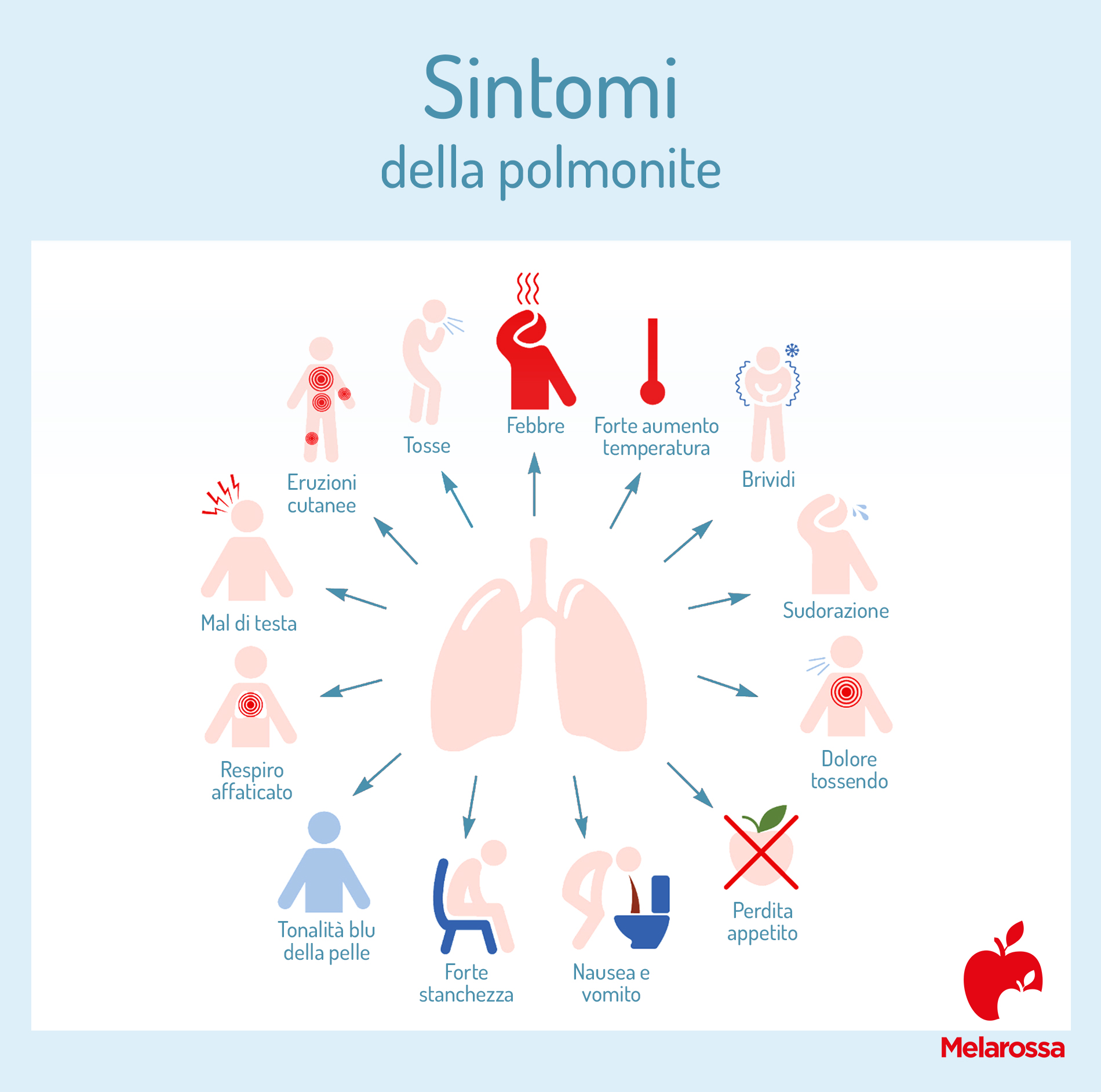 Polmonite: cos'è, sintomi, cause, cura e prevenzione 1 sintomi della polmonite