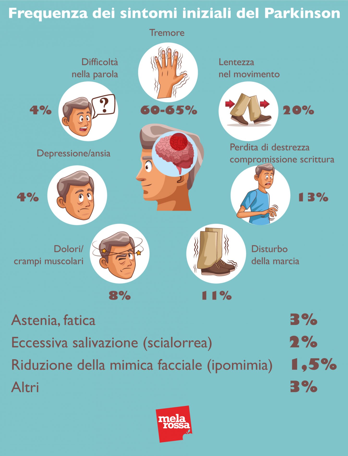 Parkinson: cos'è, epidemiologia, cause, tipi, sintomi, cura e prevenzione 5 Frequenza dei sintomi iniziali del Parkinson