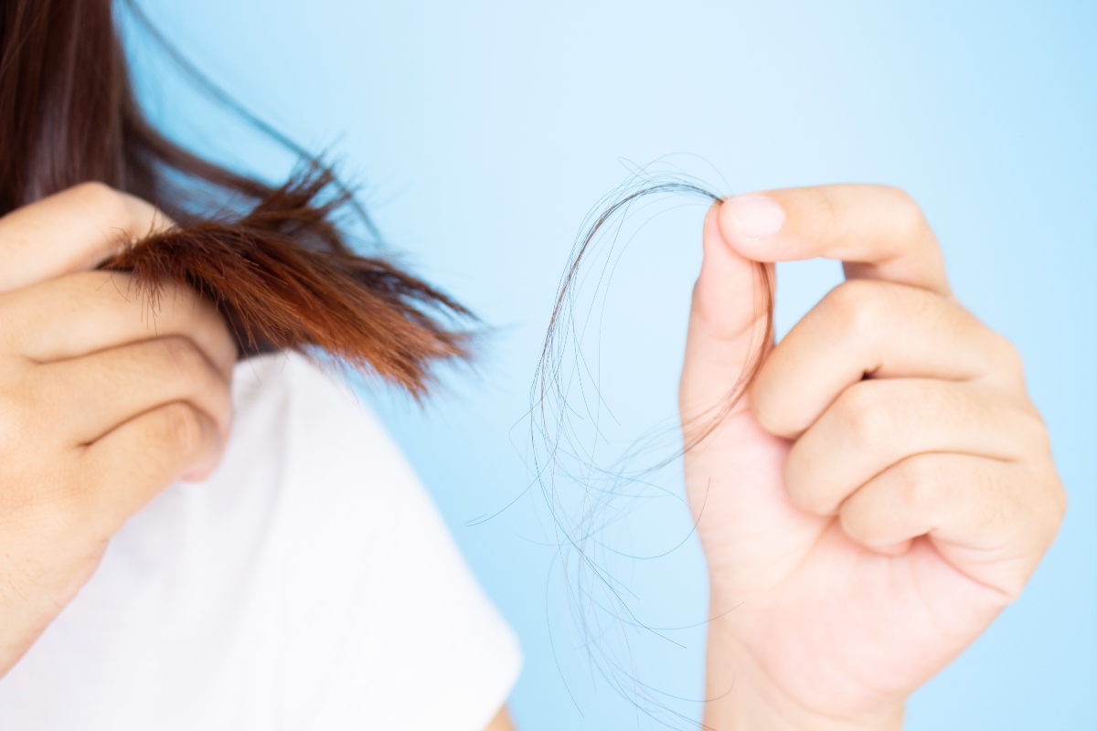 Caduta capelli: cause, i migliori rimedi per contrastarla 2 caduta capelli: cause