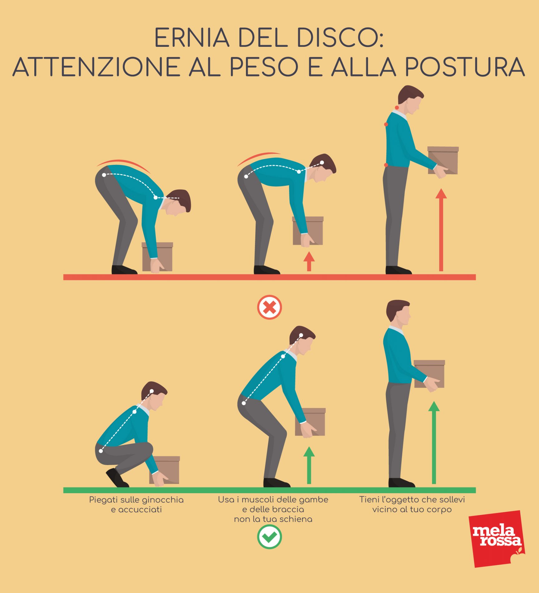 Ernia del disco: che cos'è, cause, tipi, sintomi, diagnosi e prevenzione 11 ernia del disco: come portare i pesi