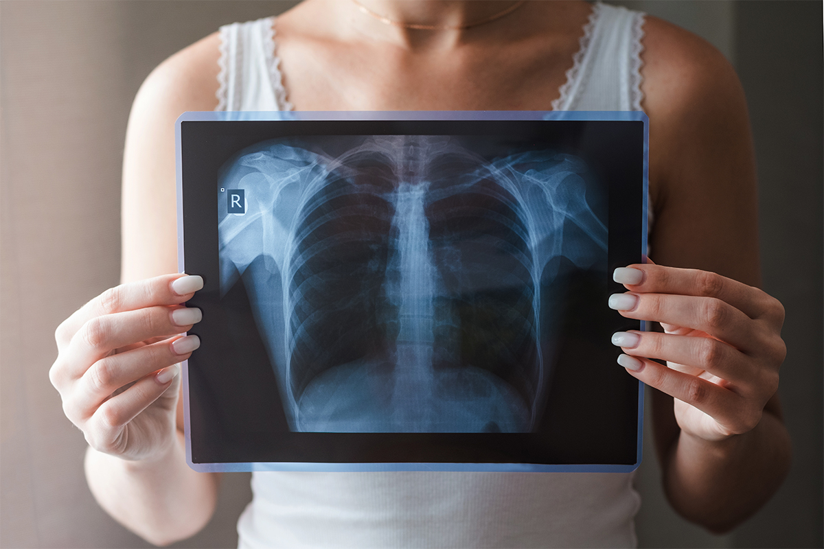Insufficienza respiratoria: che cos'è, cause, sintomi, trattamenti 2 Insufficienza respiratoria: acuta o cronica