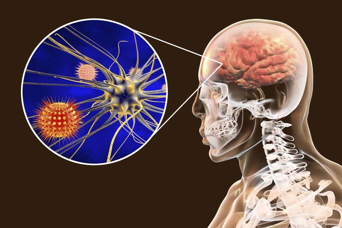 Meningite: cos'è, epidemiologia, cause, contagio, sintomi, trattamenti, decorso e prevenzione 3 meningite: anatomia