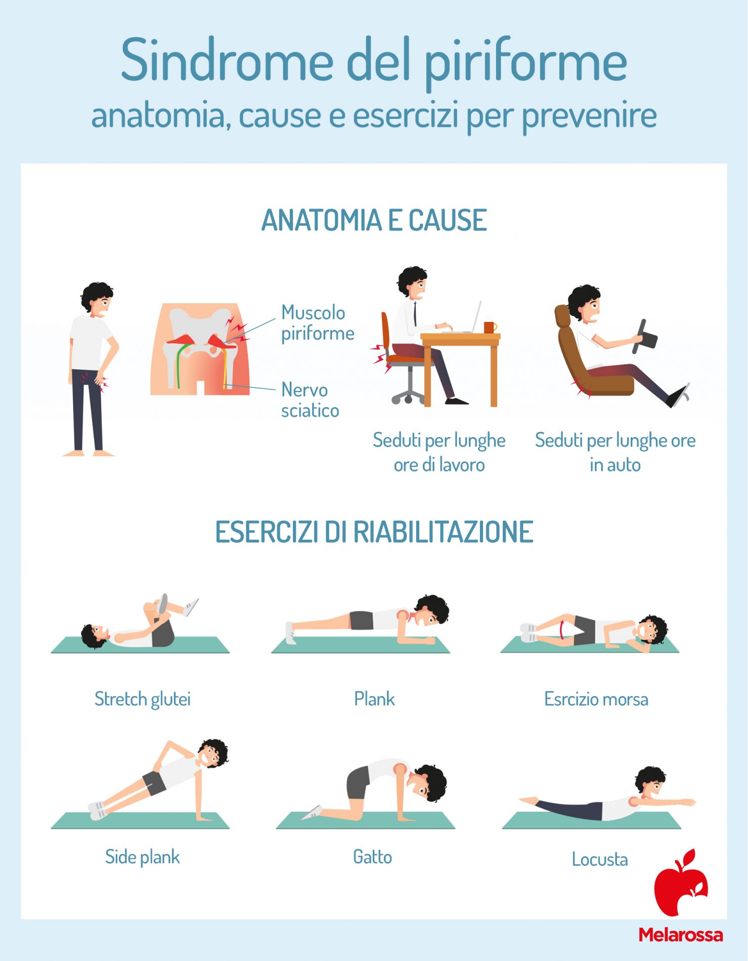 Sindrome del piriforme: cos'è, anatomia, cause, sintomi, cura e prevenzione 2 sindrome del piriforme: cause ed esercizi da fare