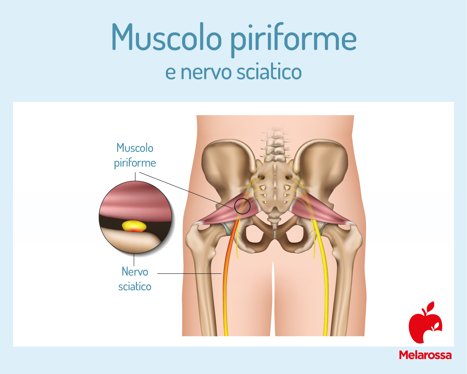 Sindrome del piriforme: cos'è, anatomia, cause, sintomi, cura e prevenzione 3 Muscolo piriforme e nervo sciatico