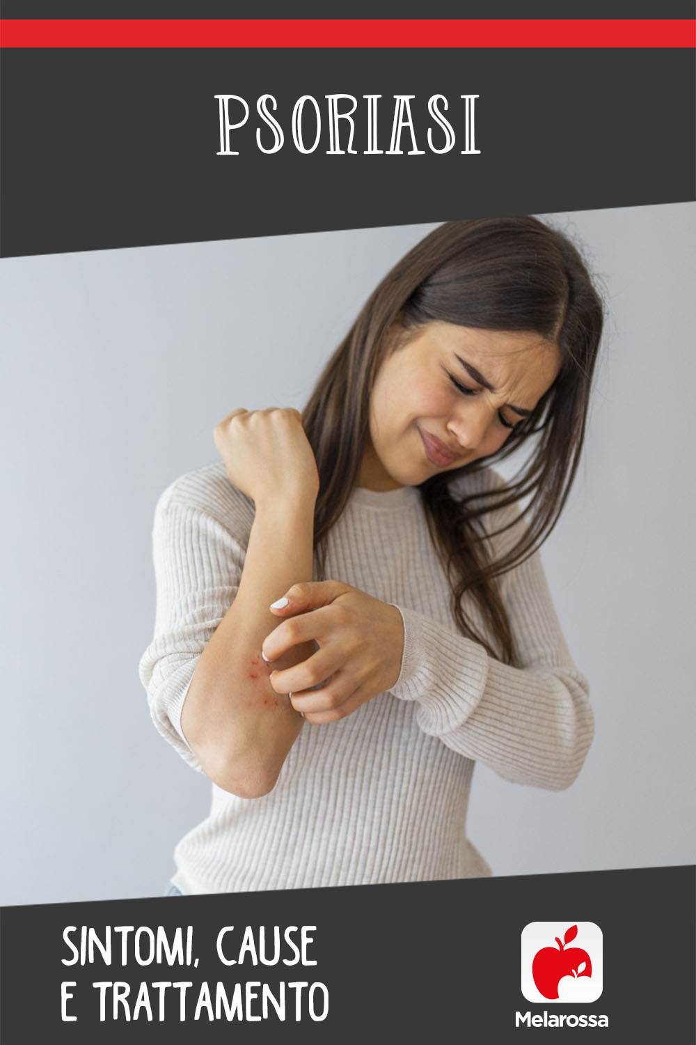 Psoriasi: cos'è, sintomi, tipi, diagnosi, cause e cure 10 Psoriasi: sintomi, cause e trattamento