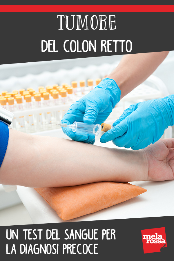 Tumore del colon retto: un test del sangue per la diagnosi precoce 1 tumore colon esame sangue