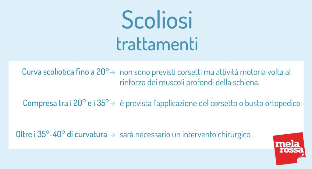 Scoliosi: cos'è, classificazioni, cause, sintomi e cura 9 Scoliosi trattamenti