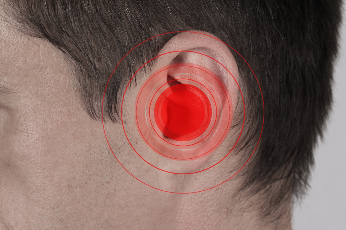 Acufene: cos'è, classificazione, cause, cure e rimedi per fischio e ronzio 6 acufene: cause