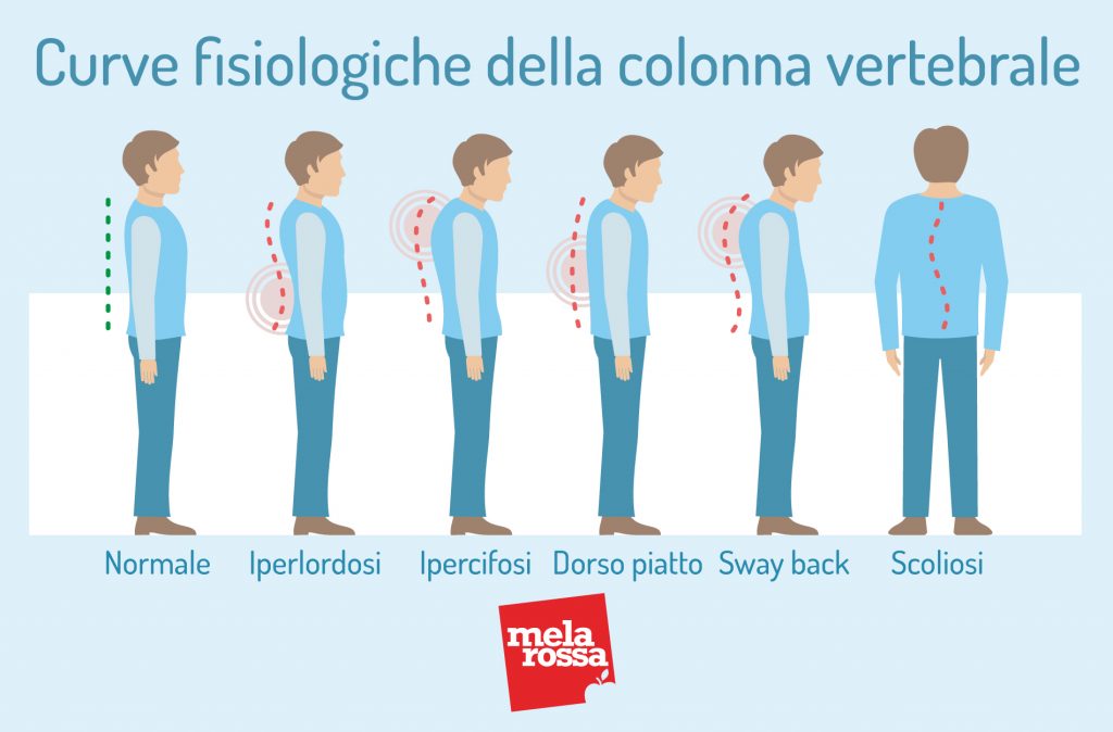 Discopatia: cos'è, tipi, cause, sintomi, cure e prevenzione 1 discopatia: curve fisiologiche