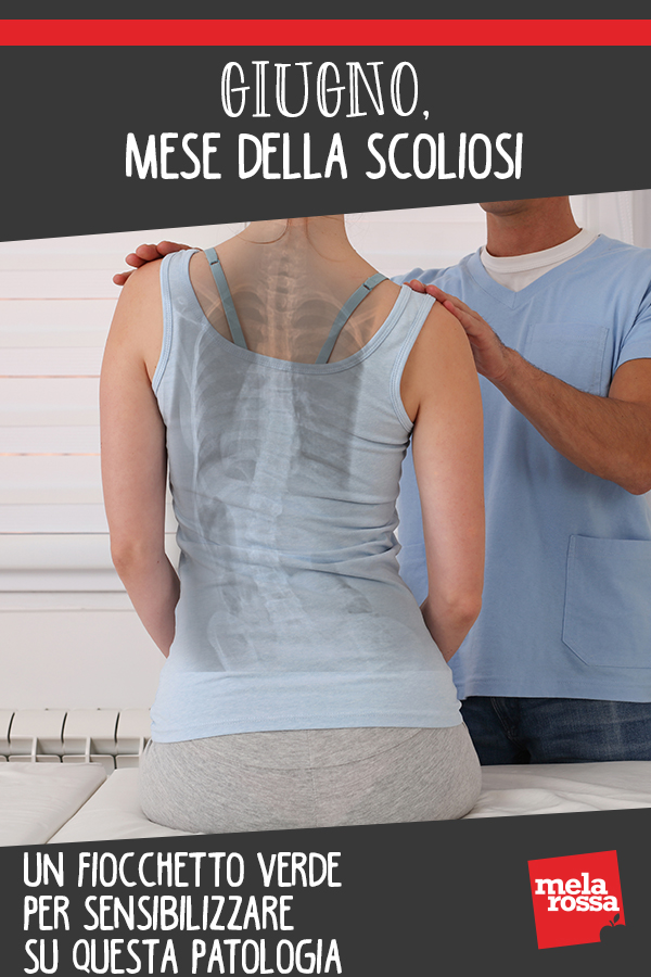 Giugno, mese della scoliosi: un fiocchetto verde per sensibilizzare su questa patologia 1 scoliosi giornata mondiale giugno