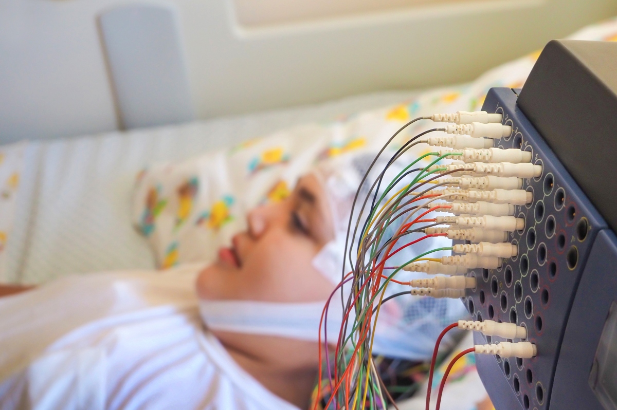 Epilessia: cos’è, sintomi, epidemiologia, diagnosi, tipi e sindrome epilettica 10 Epilessia: prognosi e decorso