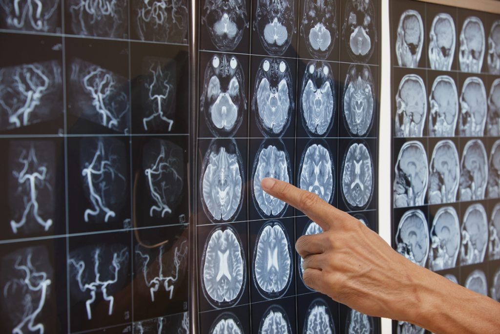 È nei neuroni che si accende il senso di responsabilità 1 cervello responsabilità