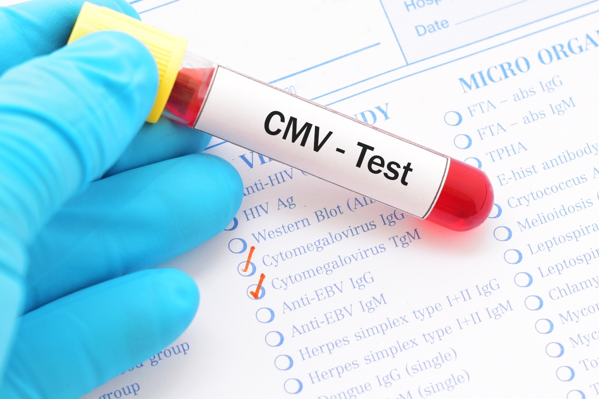 Citomegalovirus: che cos’è, sintomi, complicanze, prevenzione cura 9 citomegalovirus:test