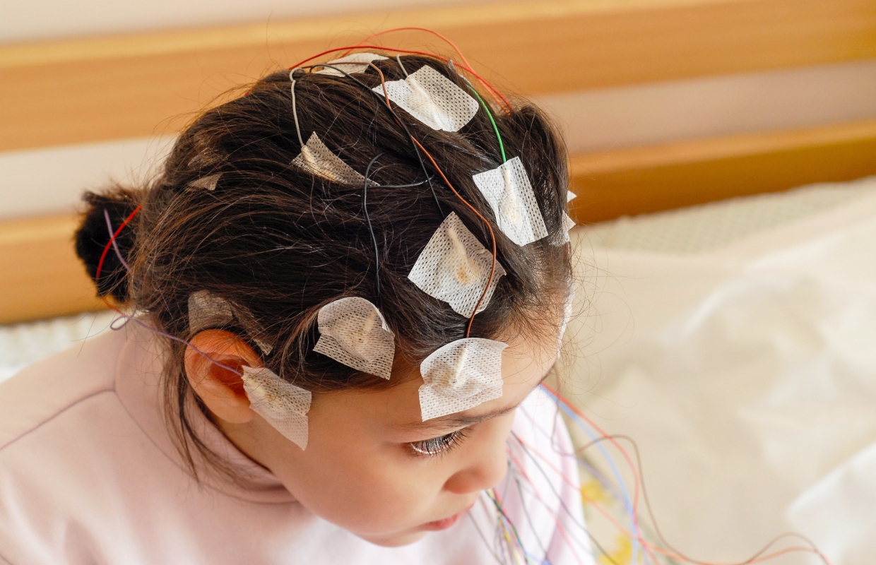 Epilessia: cos’è, sintomi, epidemiologia, diagnosi, tipi e sindrome epilettica 2 epilepsia: cause