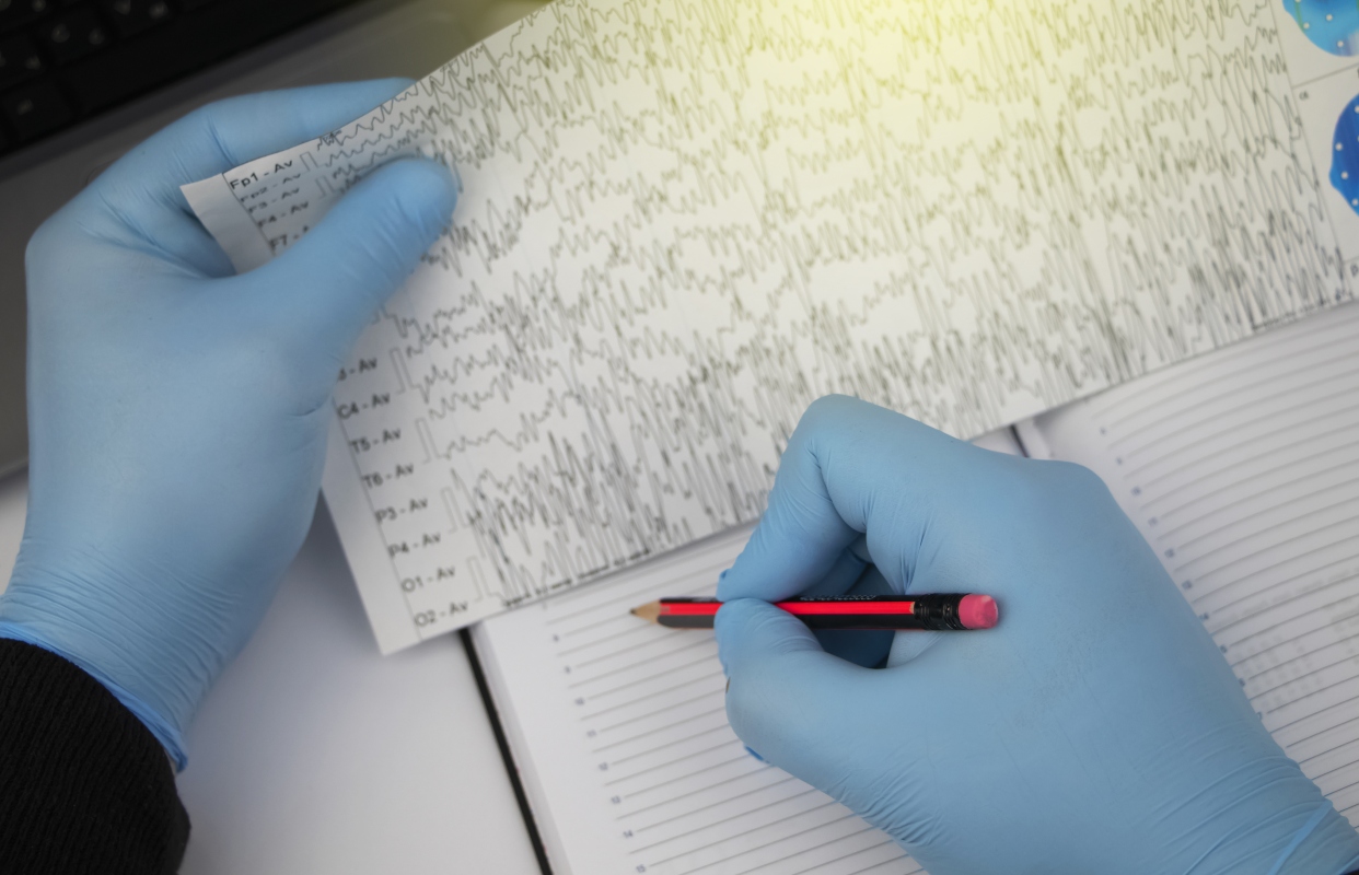 Epilessia: cos’è, sintomi, epidemiologia, diagnosi, tipi e sindrome epilettica 8 epilepsia: diagnosi