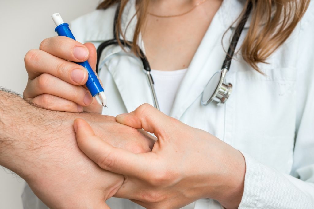 Malattia di Lyme: cos'è, cause e fattori di rischio, sintomi, diagnosi, cure e prevenzione 7 mallattia di Lyme diagnosi