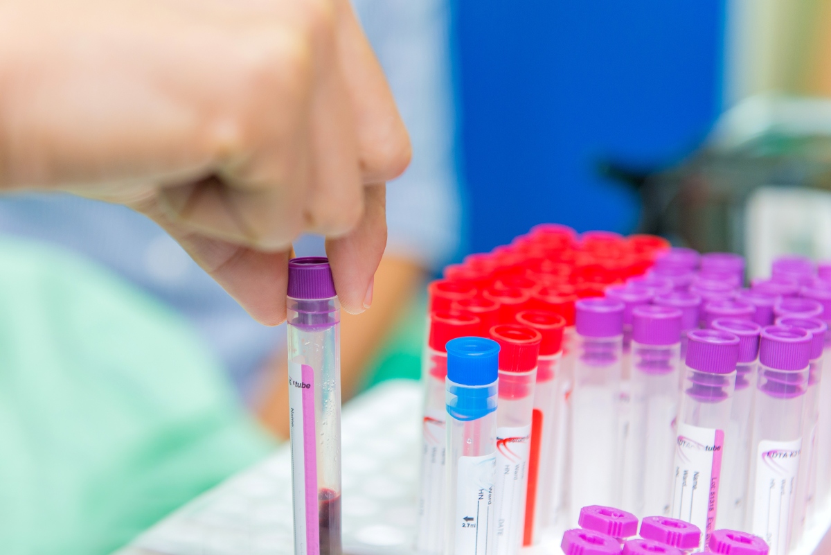 Trigliceridi alti: valori preoccupanti, esami da fare, cosa mangiare, farmaci 6 trigliceridi alti: diagnosi e esami del sangue