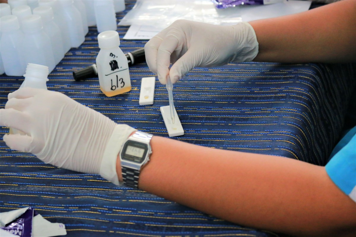 La dieta non funziona? Fai il test delle urine e ti dirò cosa mangi 3 urina impronta digitale test