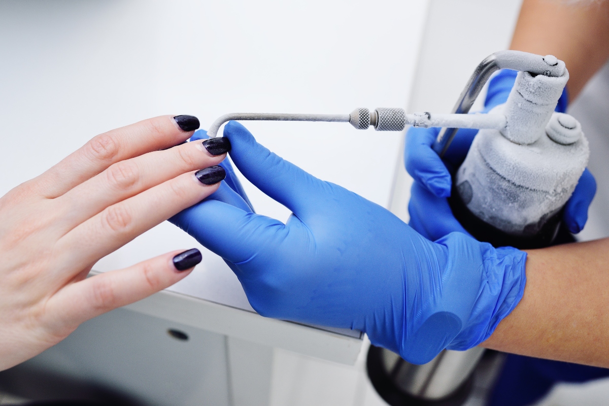 Verruche: cosa sono, sintomi, cause, cura e come prevenirle 5 verruche: cura