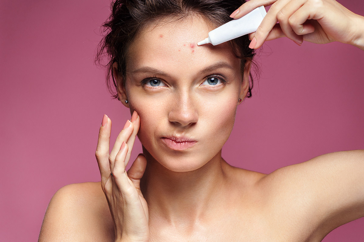 Acne: le diverse forme e come curarla anche a tavola 1 acne2
