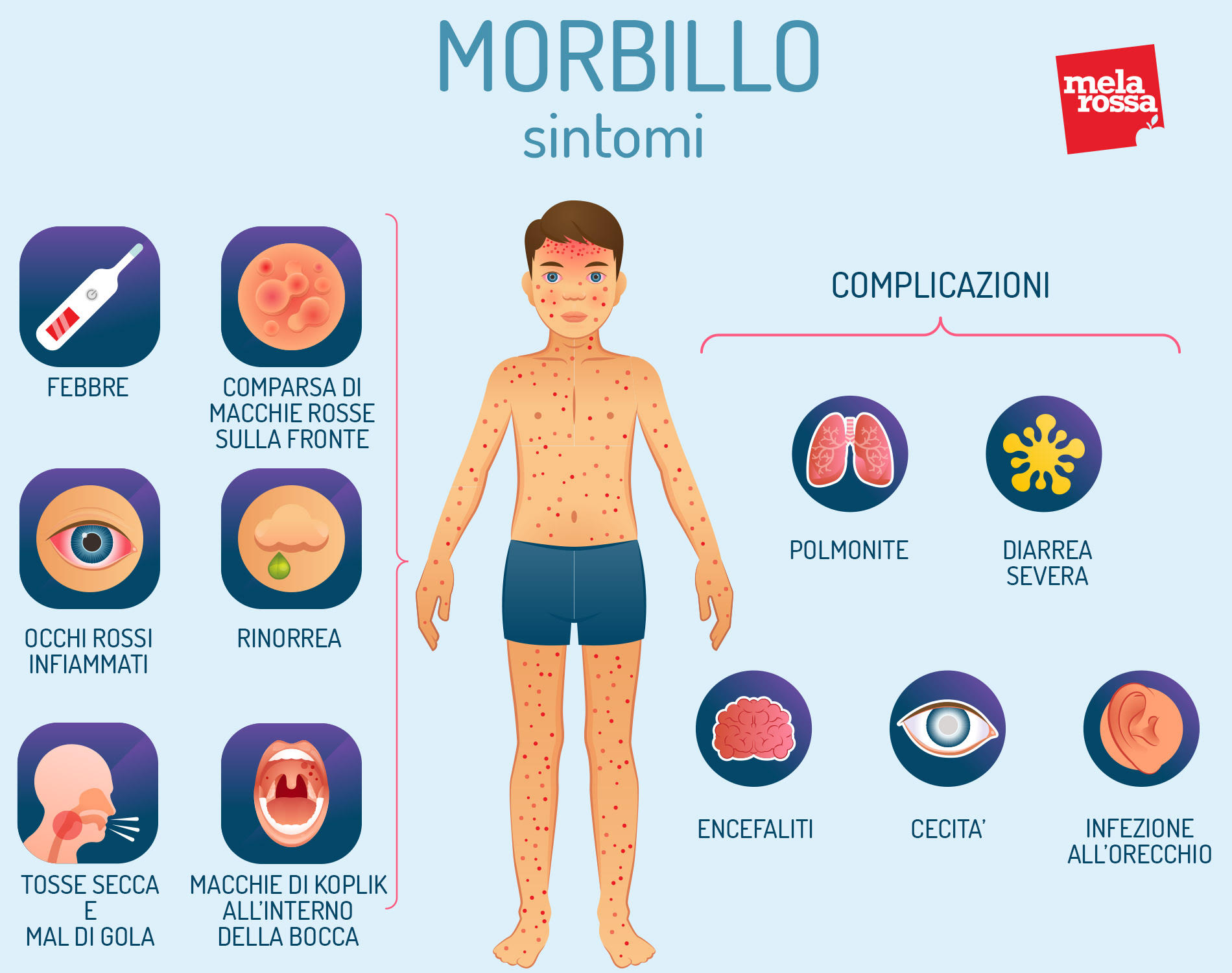Morbillo: cos'è, cause, sintomi, diagnosi, decorso, e cure 5 Morbillo: sintomi e complicazioni