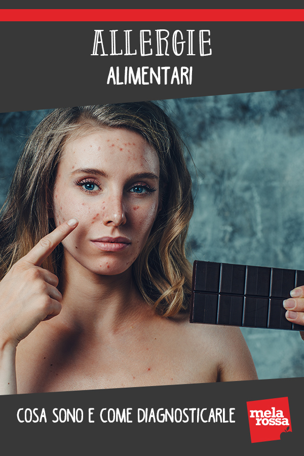 Allergie alimentari: cosa sono, sintomi, come diagnosticarle, prevenzione 4 allergie alimentari 1