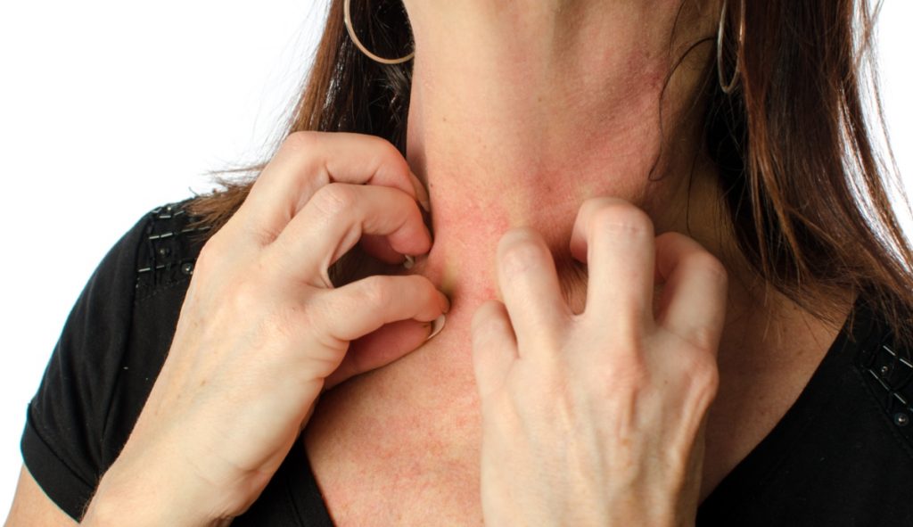 Eczema: cos'è, tipi, sintomi, cause, diagnosi e cura 2 eczema: classificazione