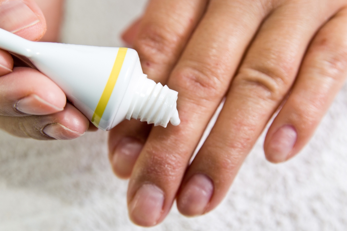 Eczema: cos'è, tipi, sintomi, cause, diagnosi e cura 7 eczema cure