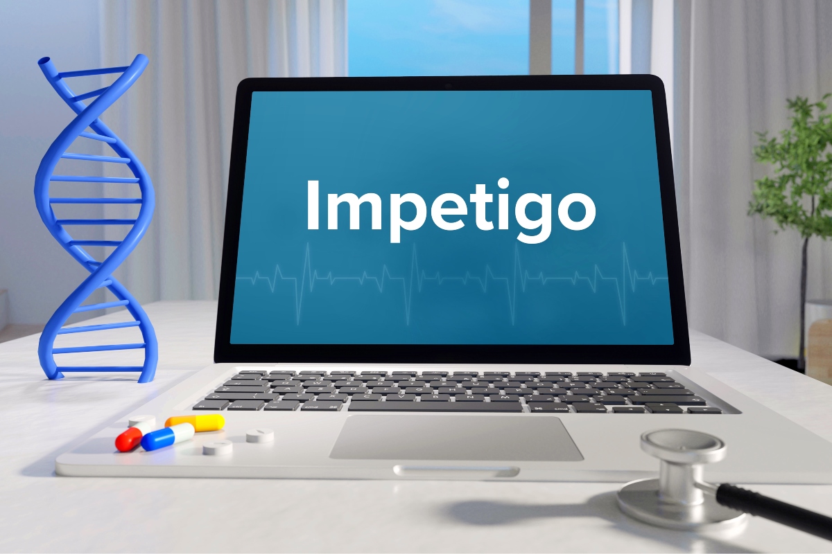 Impetigine: cos'è, cause, sintomi e cure 6 impetigine: cure