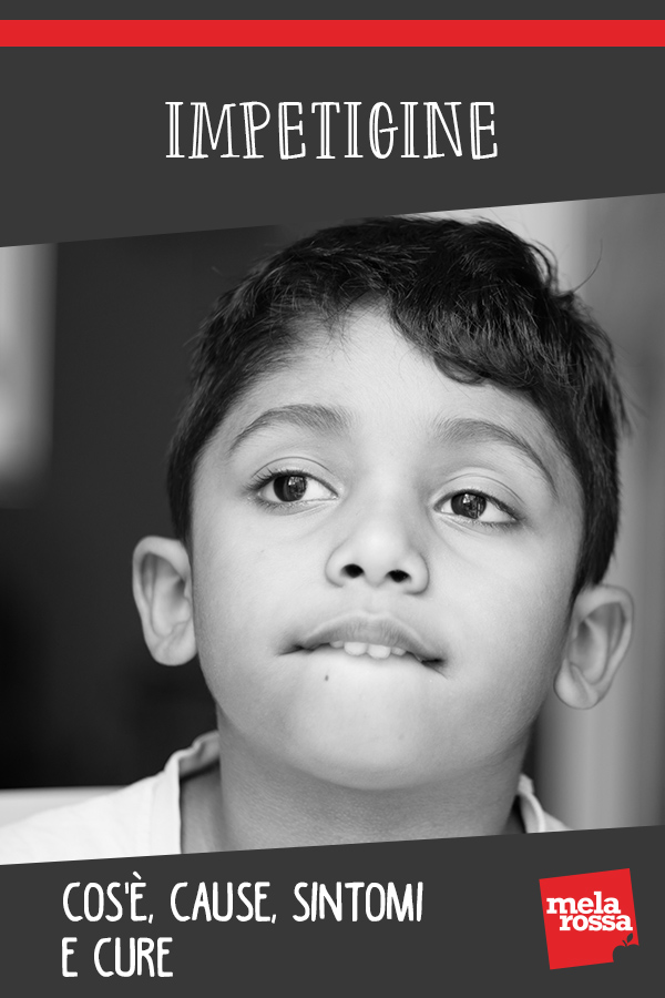 Impetigine: cos'è, cause, sintomi e cure 10 Impetigine: cos'è, cause, sintomi e cure